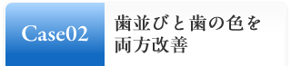 Case02:歯並びと歯の色を両方改善