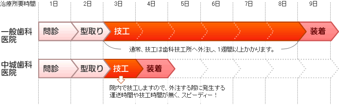 治療所要時間イメージ