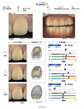 クリスタルアイ測定レポートイメージ