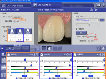 クリスタルアイ測定画面イメージ