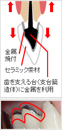 メタルボンド・ブラックマージンのイメージ