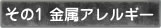 その1金属アレルギー