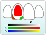 歯の色を正確に算出のイメージイラスト